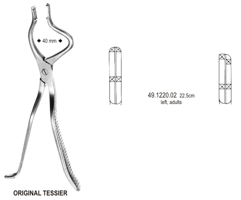 Tessier Disimpaction Fcps left 22.5cm