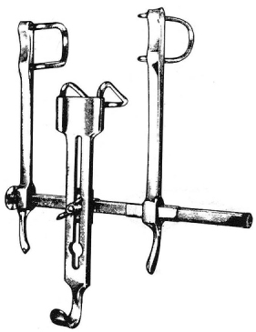 Pantings Bladder Retractor