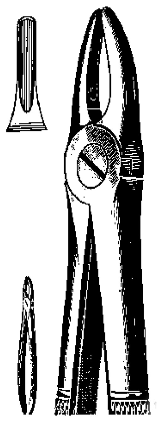 Extracting Fcps Anatomic handle Fig.2